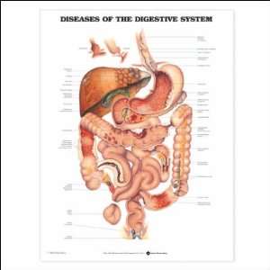  Diseases of the Digestive System Anatomical Chart 20 X 26 